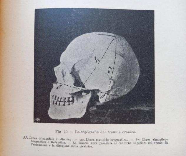 M. L. Patrizi - La Fisiologia drsquoun Bandito (Musolino) - 1904
