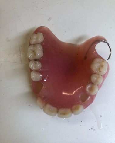 Odontotecnico Ripara Protesi Dentali1ora Domicilio Festivi Bologna
