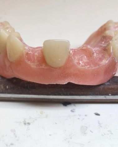 Odontotecnico Ripara Protesi Dentali1ora Domicilio Festivi Bologna