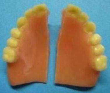 Riparazione Protesi Dentarie
